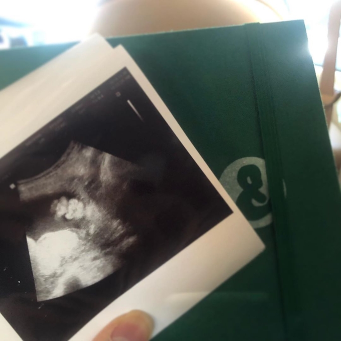 김성은 사진출처=인스타그램